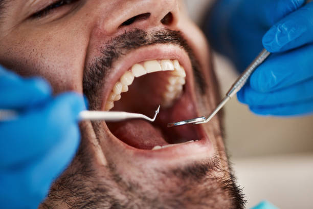 Best Emergency Care for Gum Disease in Walnut, IL